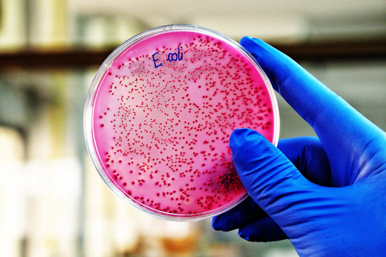 Una placa de laboratorio con un cultivo de E. coli.