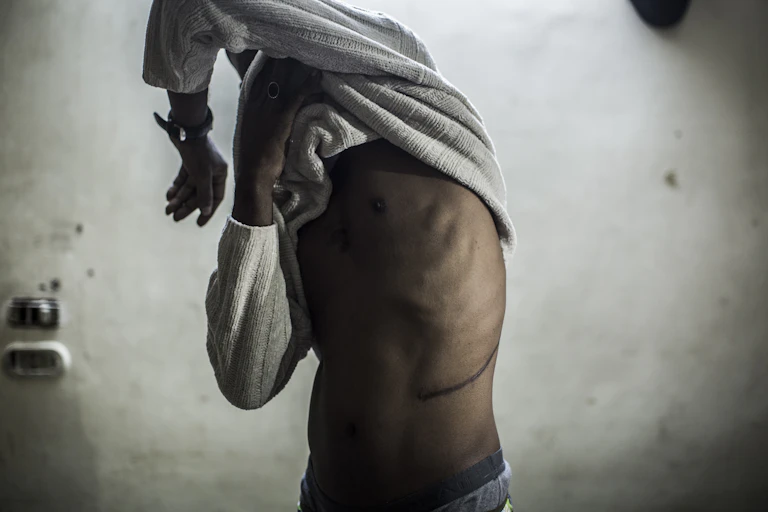 A man lifts his shirt to show a scar