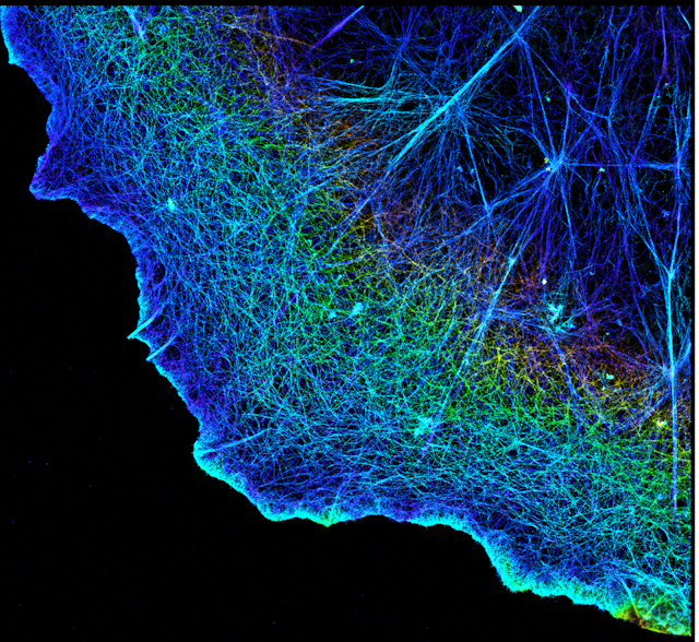 Microscopy image of actin filaments crisscrossing enough other in a dense network of thin lines