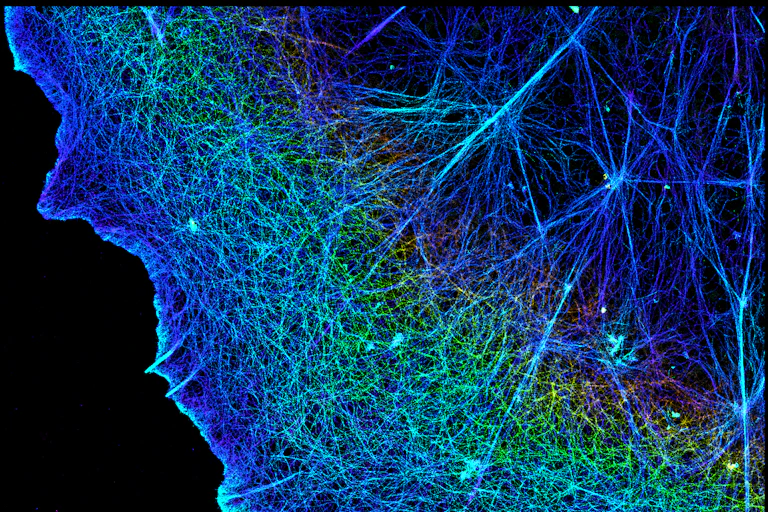 Microscopy image of actin filaments crisscrossing enough other in a dense network of thin lines