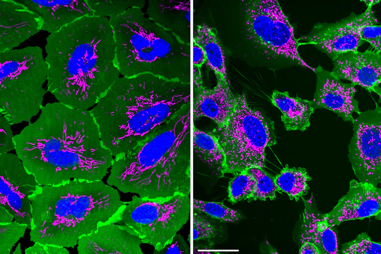 Deux images de microscopie confocale