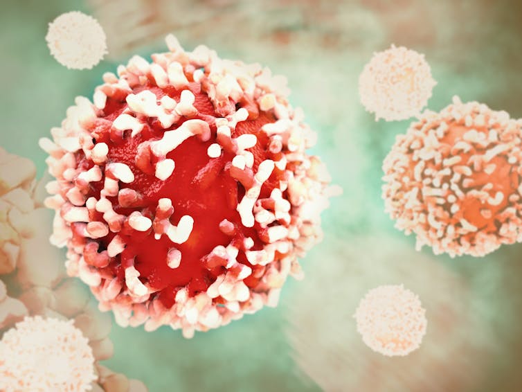 A digital illustration of a cancer cell.