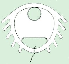 Sketch of a Dalkon shield IUD