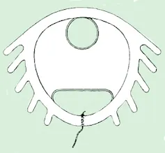 Sketch of a Dalkon shield IUD
