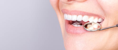 Smile! What are veneers and what do they do to your natural teeth?