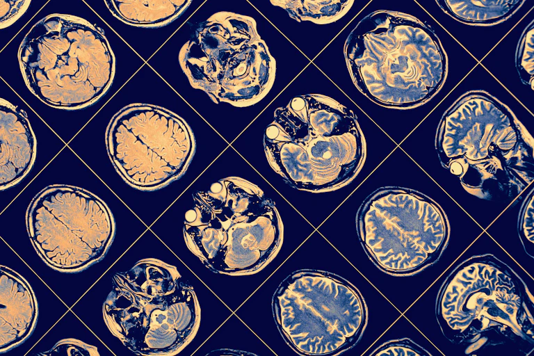 Brain scans
