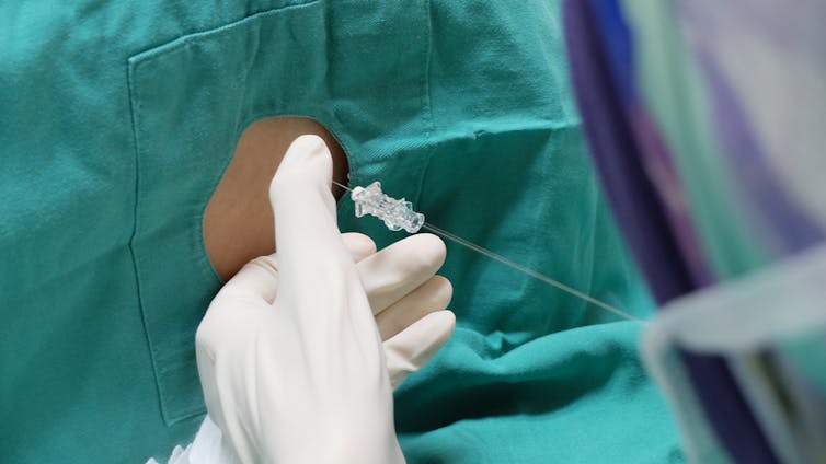 Person receiving a lumbar puncture.