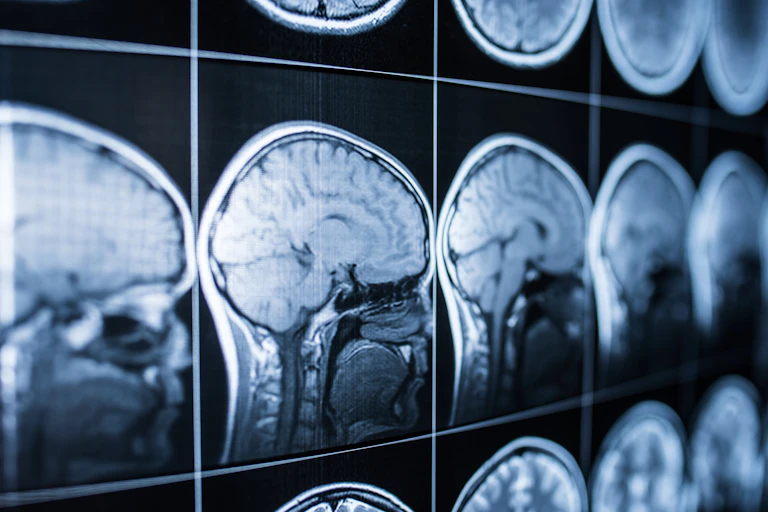 Scans of the human brain.