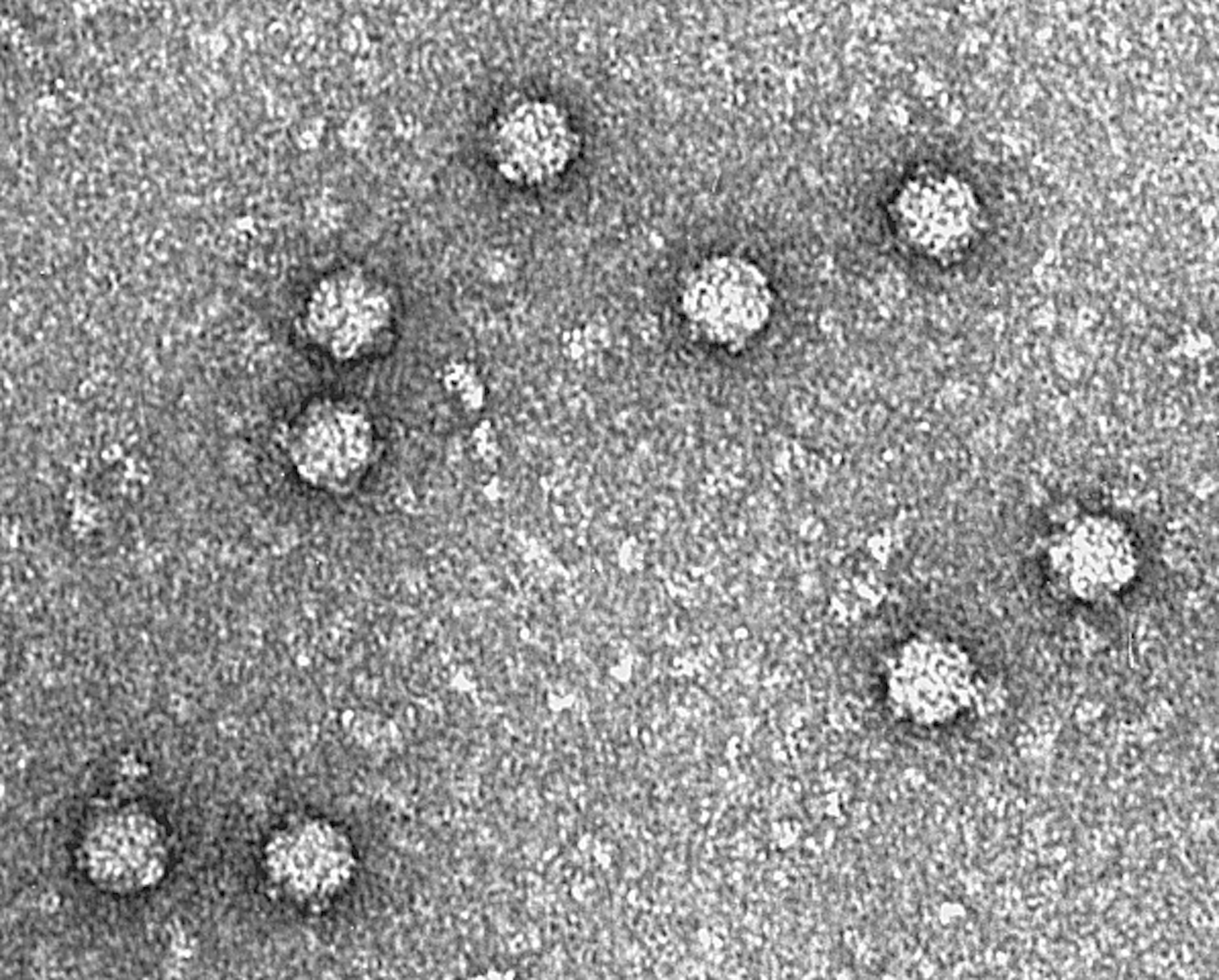 Mengenal bakteriofag: virus baik yang melawan infeksi bakteri mirip antibiotik