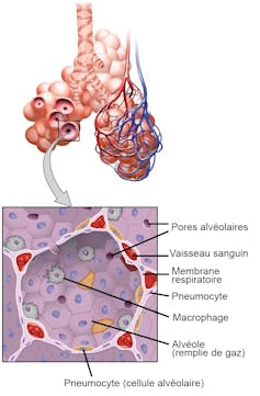 Illustration d’une petite section de poumons montrant les alvéoles et, à l’intérieur des alvéoles, des macrophages