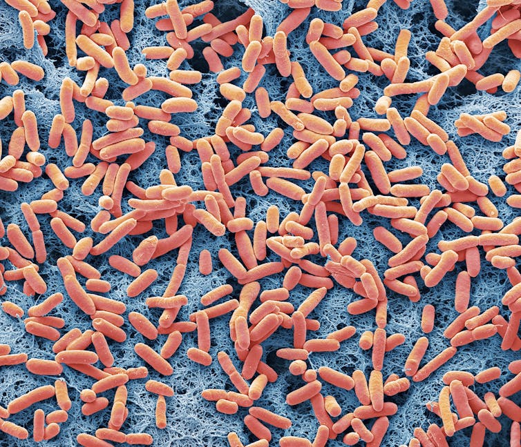 Microscopy image of E. coli, colored orange