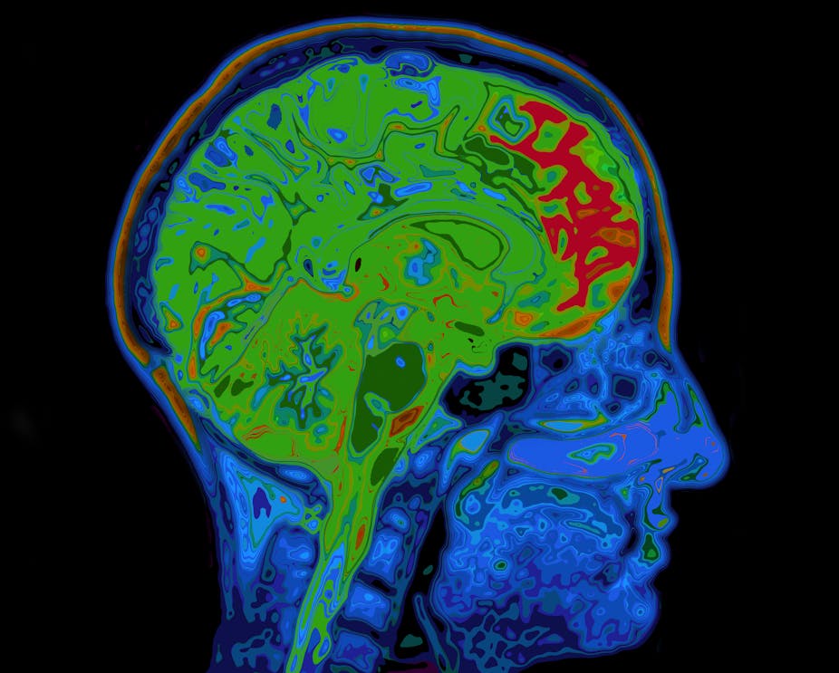 MRI Immagine del cervello.