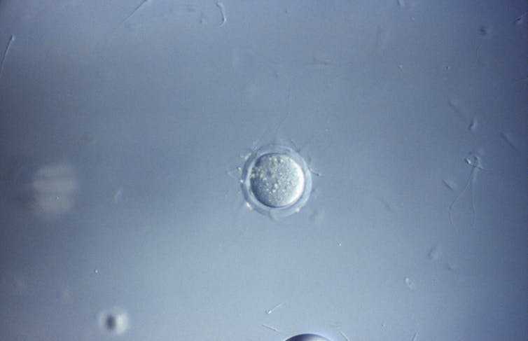 Microscopy image of mouse ovum being fertilized by mouse sperm