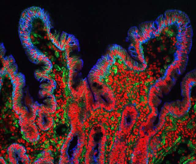 microscopie cryo de muqueuse intestinale