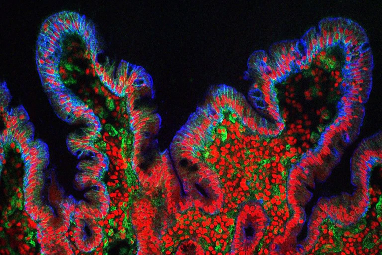 microscopie cryo de muqueuse intestinale