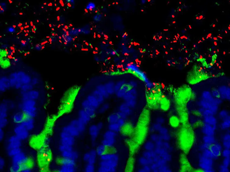 microscopie d’intestin grêle