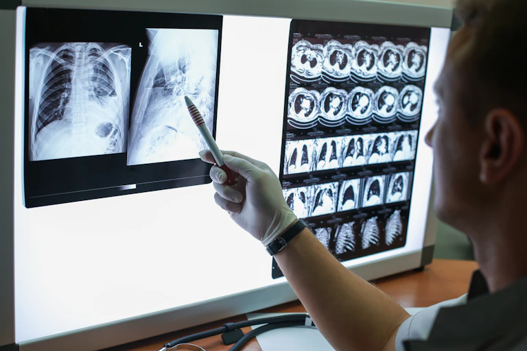 Medical person looking at scans of lungs
