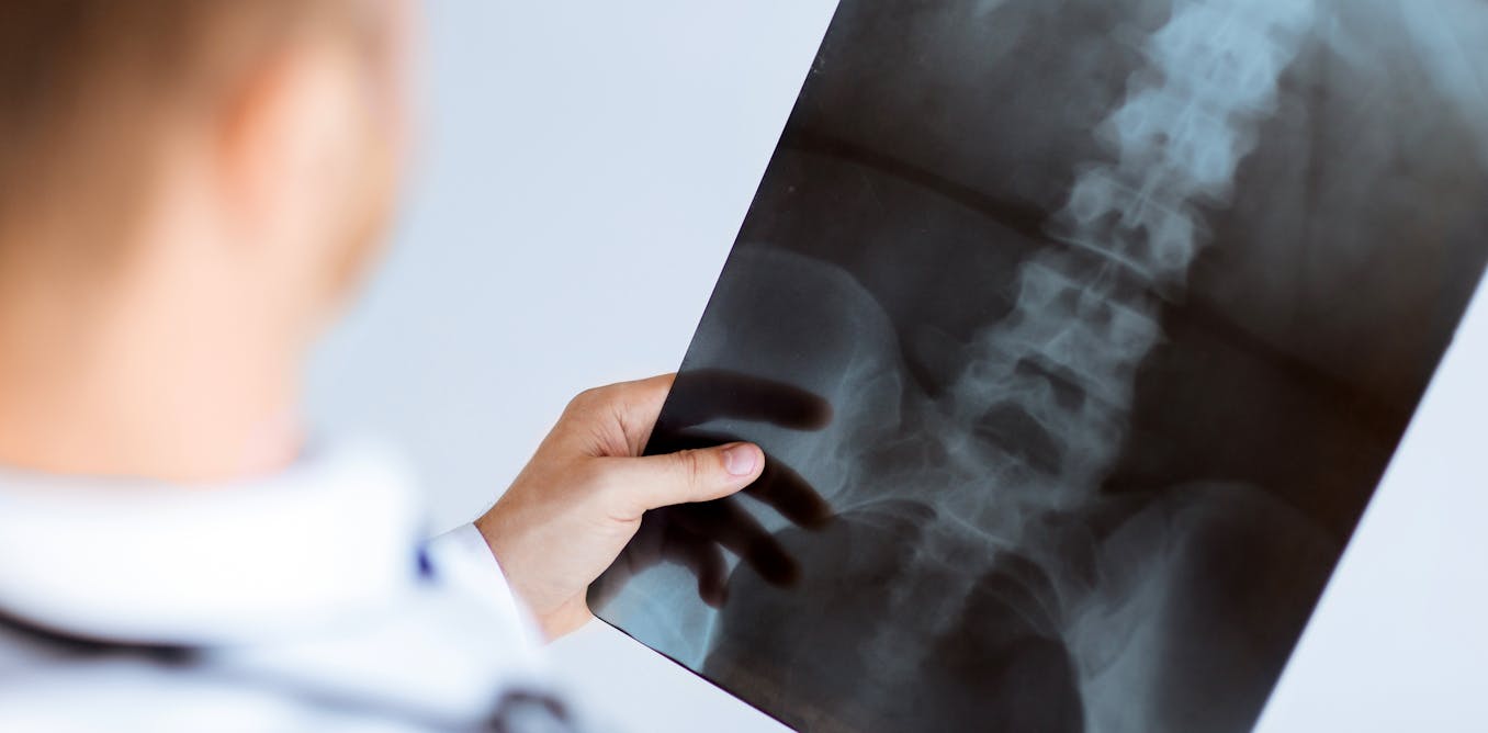 Que montre vraiment l'imagerie médicale en cas de mal de dos ?