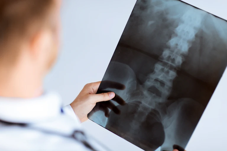 Médecin tenant une radio des lombaires