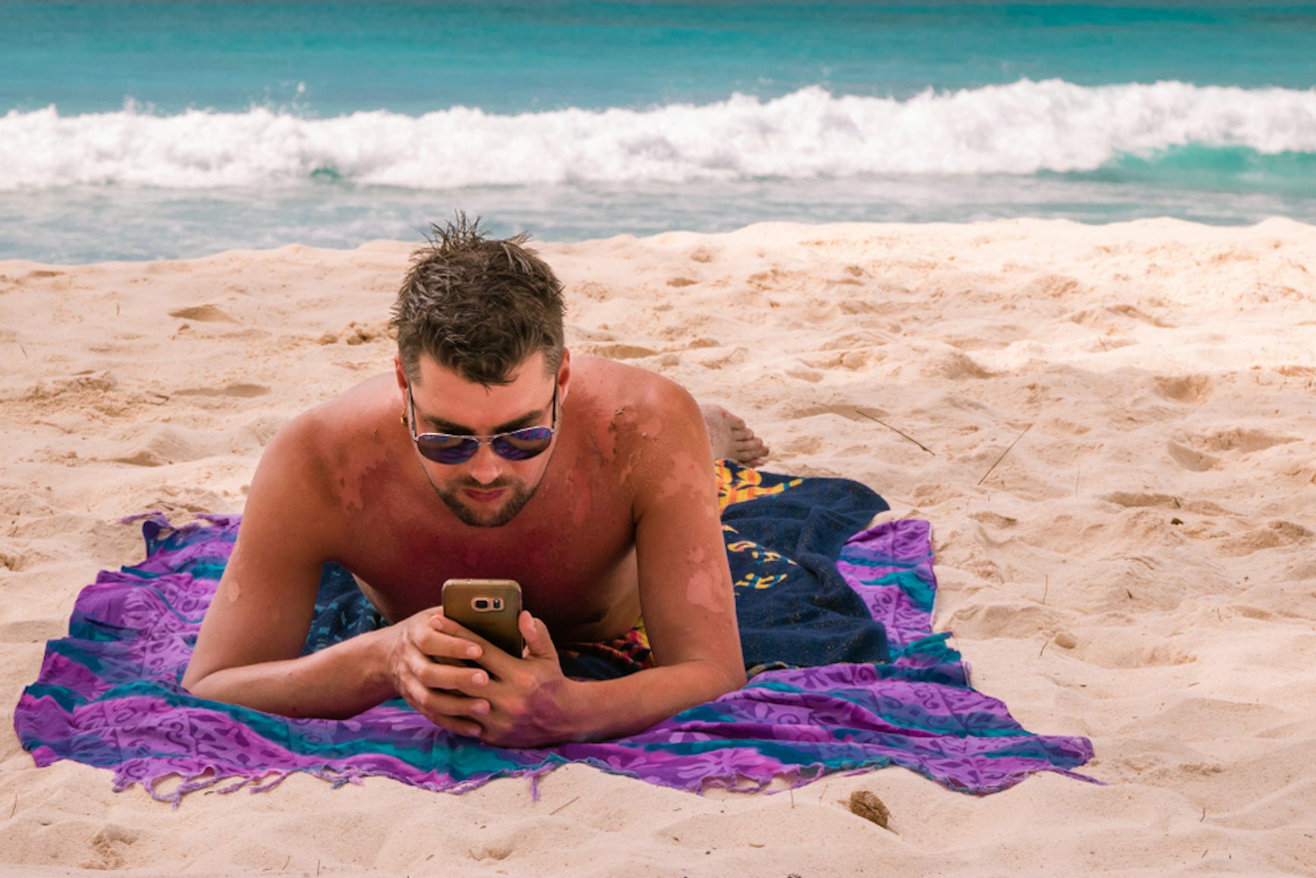 Un homme regarde son téléphone sur la plage, le dos et les bras couverts de cicatrices après avoir pelés