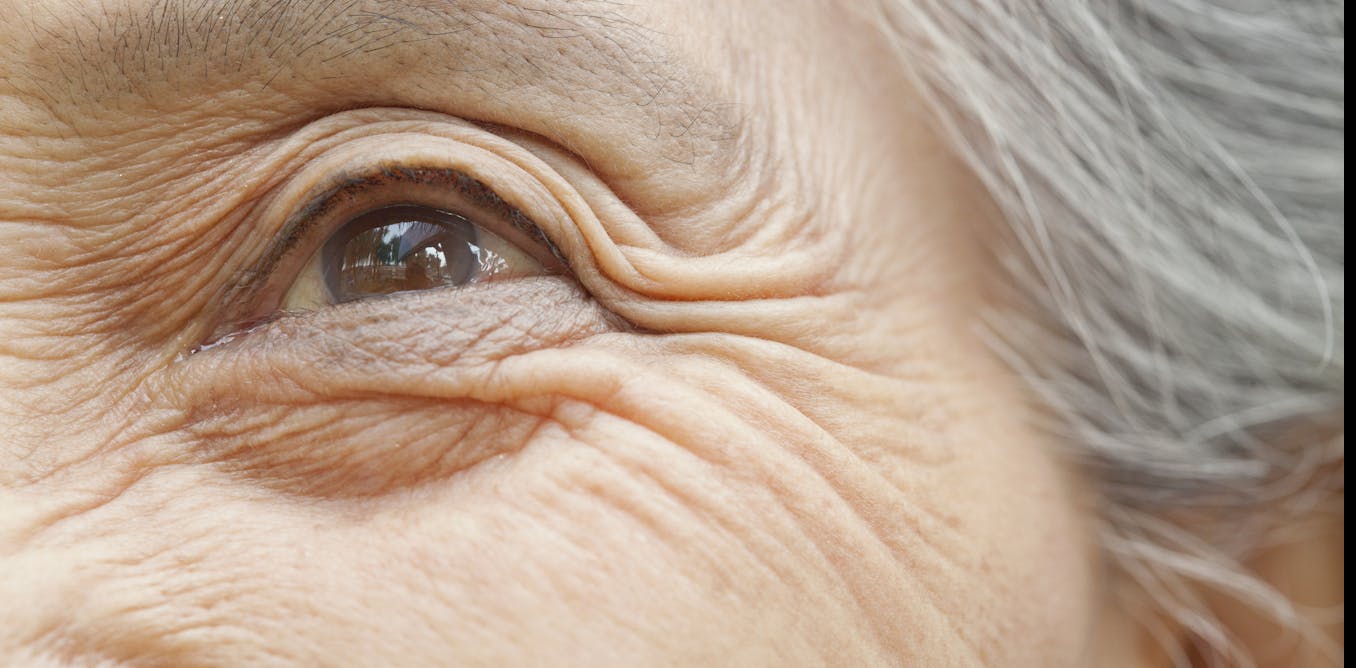 Aging is complicated – a biologist explains why no two people or cells age the same way, and what this means for anti-aging interventions