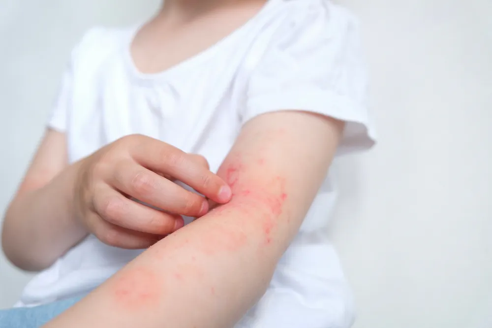 Bleach Treatment For Wounds bleach-treatment-for-wounds