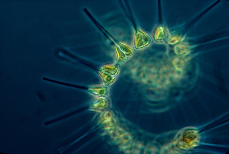 A closeup of phytoplankton (microscopic marine algae)
