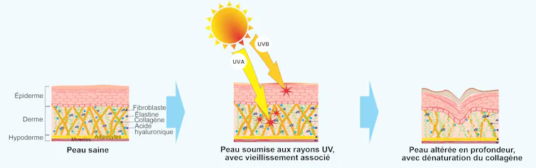 Illustration des effets des UV.