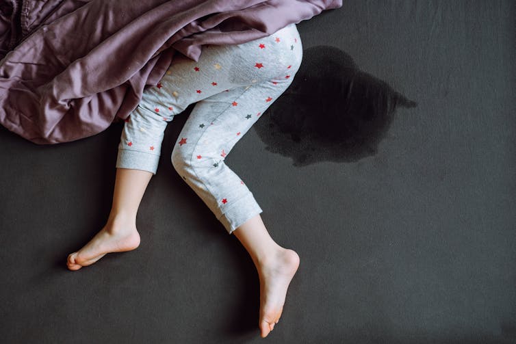 A child's legs, wearing pajama pants, against a grey floor. A wet stain is visible on their bottom and on the ground behind them.