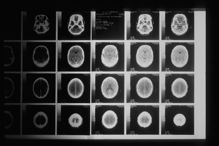 What happens when doctors don’t act as they should? And what's the ruling against neurosurgeon Charlie Teo?