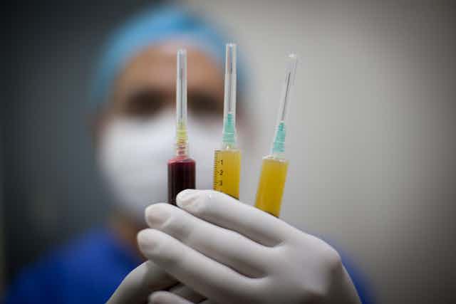 Medic performing the stem cell separation process to apply them to a patient in treatment of regeneration of knee joint