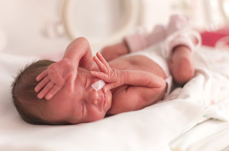 A premature baby girl in an incubator.