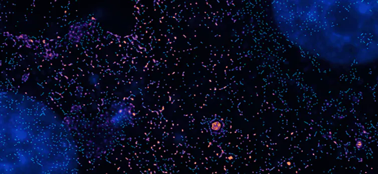 Two blue blobs, one at the bottom left and one at the top right, are separated by pink and blue specks on a black background.
