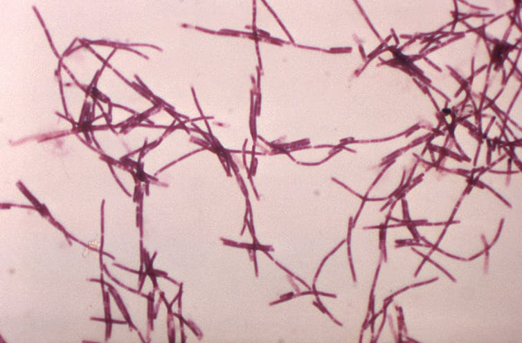 Bacillus anthracis