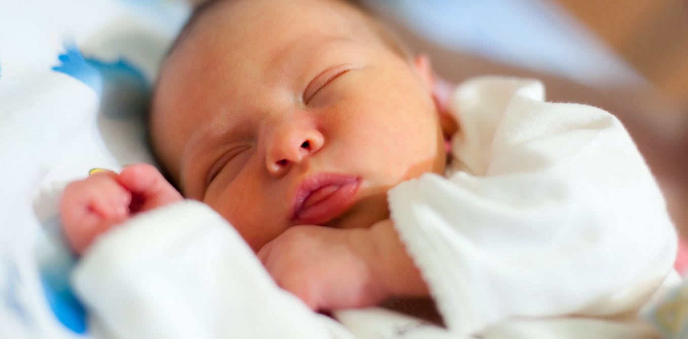 Желтуха у доношенного новорожденного. Физиологическая желтуха новорожденных. Желтушка у новорожденного. Желтуха у новорожденных фото. Что такое желтушка у новорожденных детей.