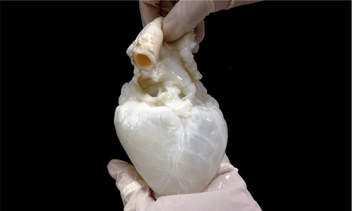 Lab-grown ‘ghost hearts' work to solve organ transplant shortage by combining a cleaned-out pig heart with a patient’s own stem cells