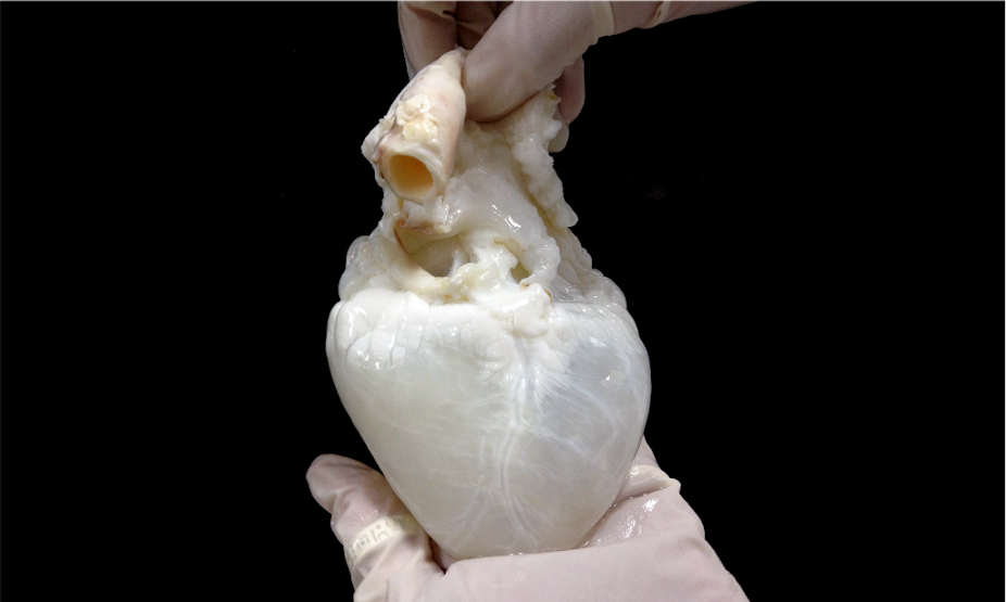 Two hands in rubber gloves hold a ghost heart – a pig heart turned white. 