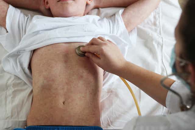 A doctor puts a stethoscope to the chest of a child with a rash.