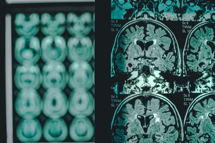 CT scan films displayed