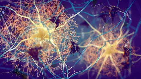 Alzheimer's drug donanemab has been hailed as a 'turning point' for treatment. But what does it mean for people with the disease?