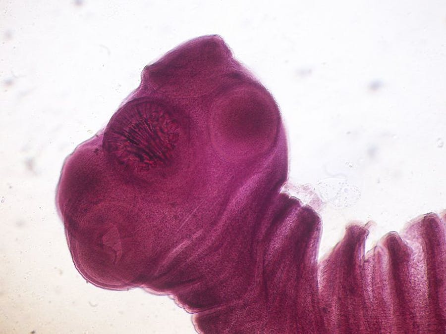The Top Ten Parasites That Could Be Lurking In Your Food