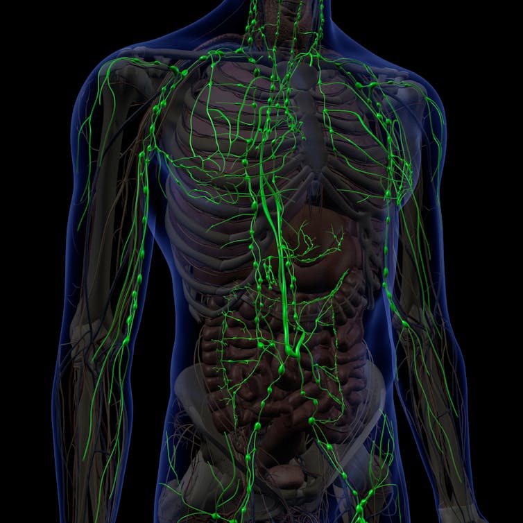 diagram of human torso with green lines showing lymph nodes and vessels