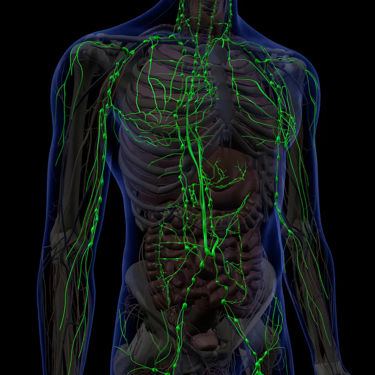 diagram of human torso with green lines showing lymph nodes and vessels