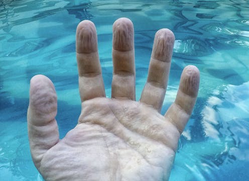 Why do fingers get wrinkly after a long bath or swim? A biomedical engineer explains
