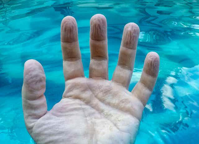 A hand with the palm facing up is wrinkled and shriveled due to the long stay in the water