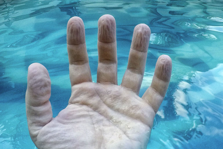 A hand with the palm facing up is wrinkled and shriveled due to the long stay in the water