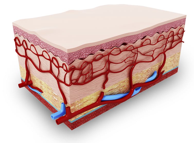 Artist's rendering of a cross-section of skin, showing the network of blood vessels beneath the surface.