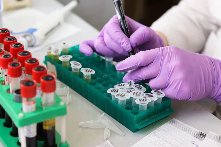 Blood samples in vials being tested in a lab