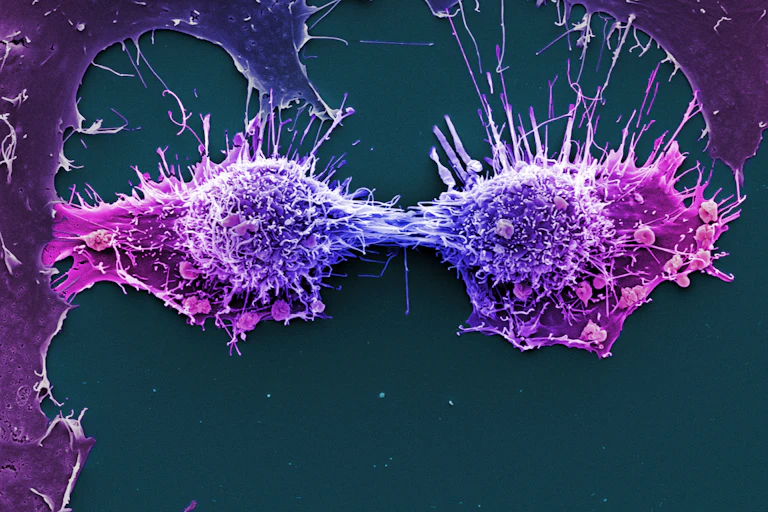 HeLa cells dividing: microscopic image of cells dyed blue and pink