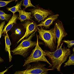 Microscopic image of cells dyed blue and yellow